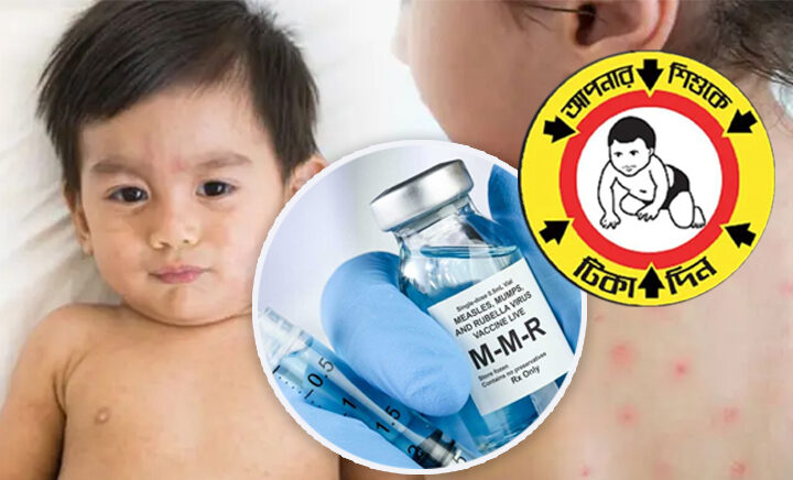 ৩০ উপজেলায় হাম-রুবেলার টিকাদান শুরু