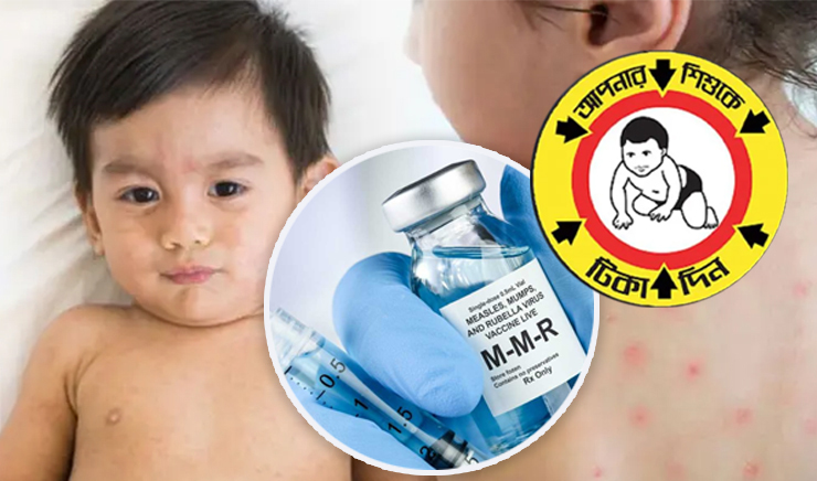 ৩০ উপজেলায় হাম-রুবেলার টিকাদান শুরু